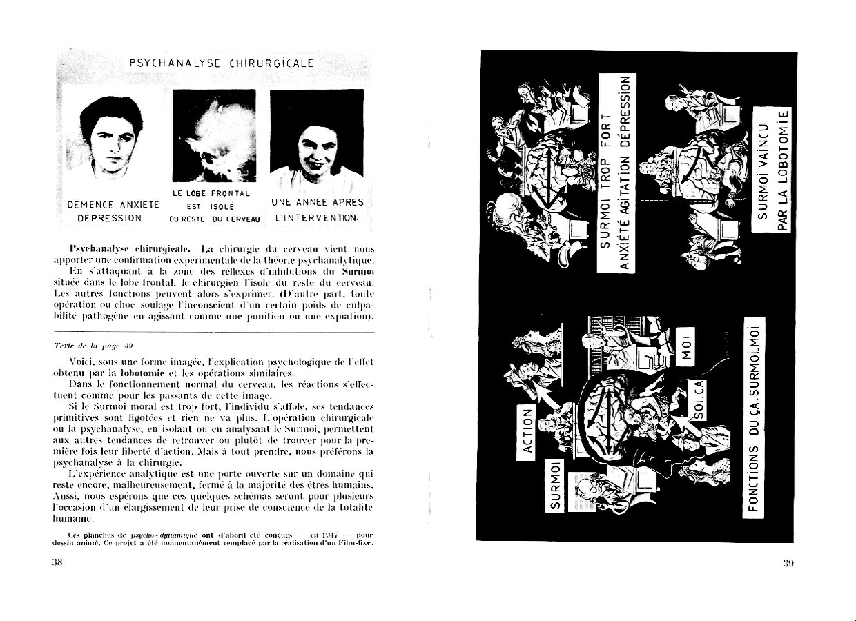 lobotomie, &ccedil;a surmoi - moi